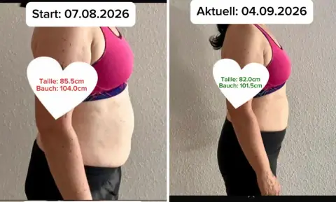 Anonym: Vorher-Nachher