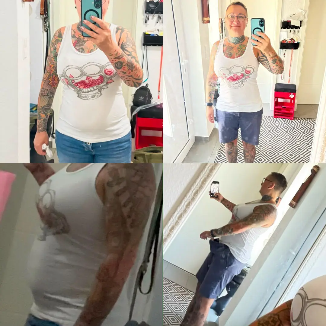 Sonja: Vorher-Nachher-Vergleich